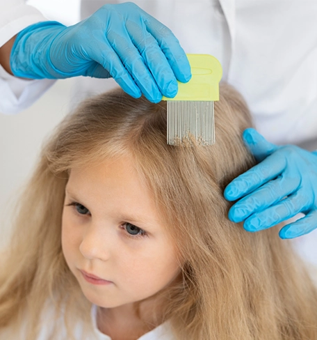 Lice and Nits